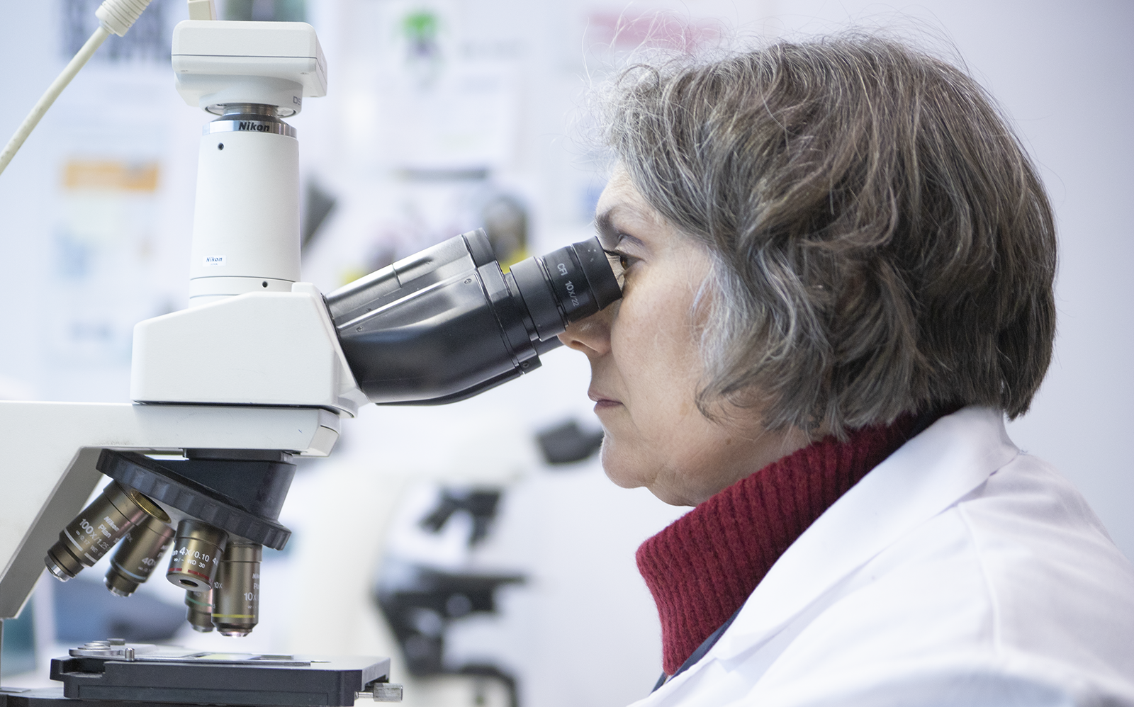 Inovação em Histopatologia. Já é possível fazer a classificação de linfoma em amostras líquidas.